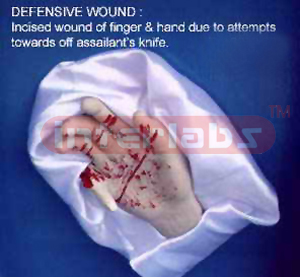 Defence Wounds